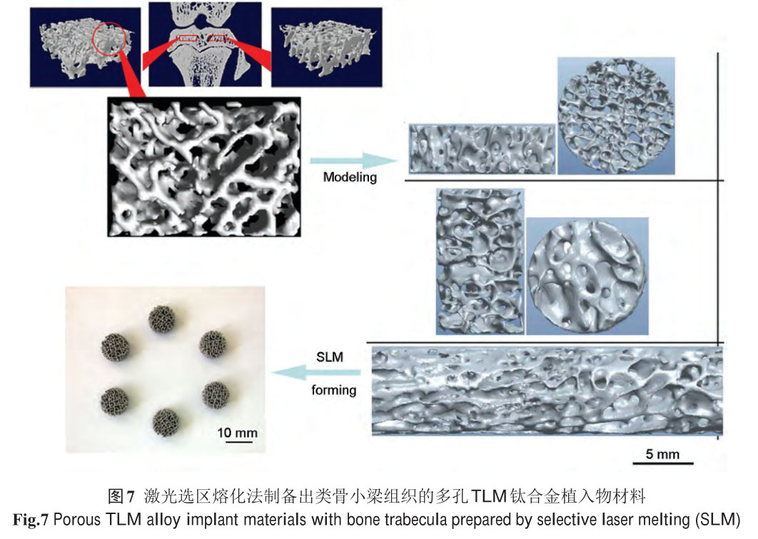 新型醫(yī)用鈦合金材料的研發(fā)和應(yīng)用現(xiàn)狀